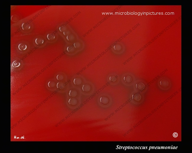 colonies typical of pneumococcus, colony morphology